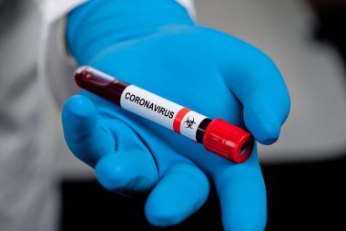 Corona virüsü salgını. Salgın Virüsü Solunum Sendromu.