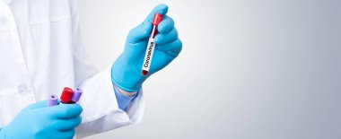 Corona virüsü salgını. Salgın Virüsü Solunum Sendromu.