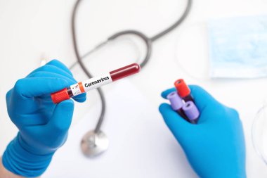 Corona virüsü salgını. Salgın Virüsü Solunum Sendromu.