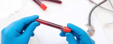 Corona virüsü salgını. Salgın Virüsü Solunum Sendromu.