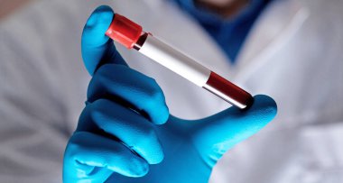 Corona virüsü salgını. Salgın Virüsü Solunum Sendromu.