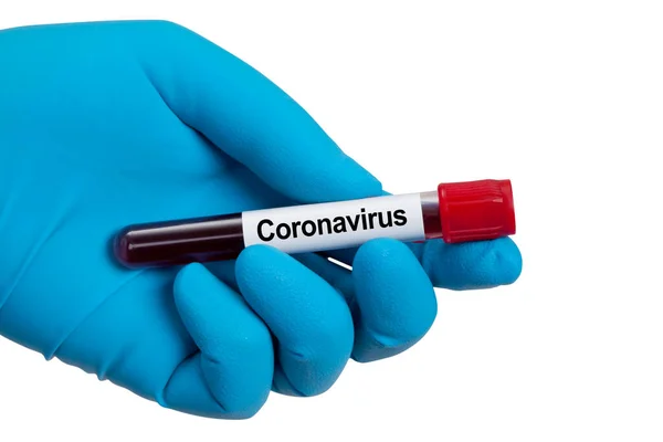 Brote Del Virus Corona Virus Epidémico Síndrome Respiratorio — Foto de Stock