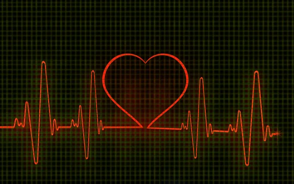 Computergrafik Eines Herzförmigen Elektrokardiogramms Ecg Ein Ekg Misst Die Elektrische — Stockfoto