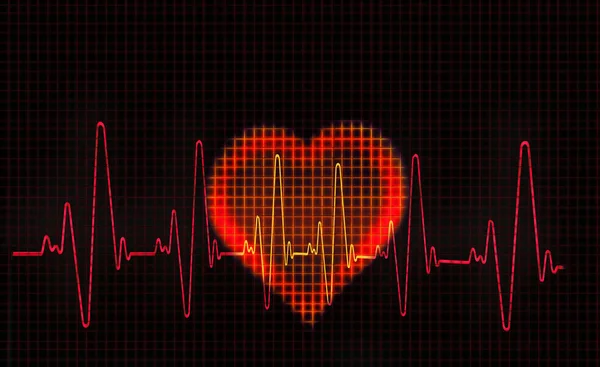 Computergrafik Eines Herzförmigen Elektrokardiogramms Ecg Ein Ekg Misst Die Elektrische — Stockfoto