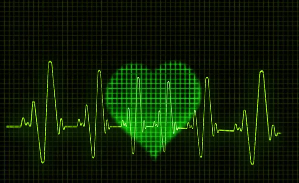心形心电图 Ecg 痕迹的计算机艺术品 测量心脏的电活动 — 图库照片
