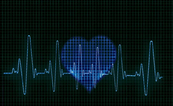 ハート型心電図 Ecg トレースのコンピューターのアートワーク 心電図は心臓の電気的活動を測定します — ストック写真