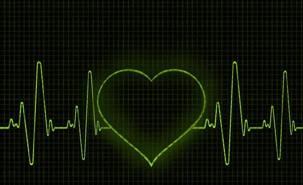 Computergrafik Eines Herzförmigen Elektrokardiogramms Ecg Ein Ekg Misst Die Elektrische — Stockfoto