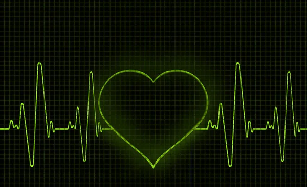 Computer artwork of a heart-shaped electrocardiogram (ECG) trace. An ECG measures the electrical activity of the heart.