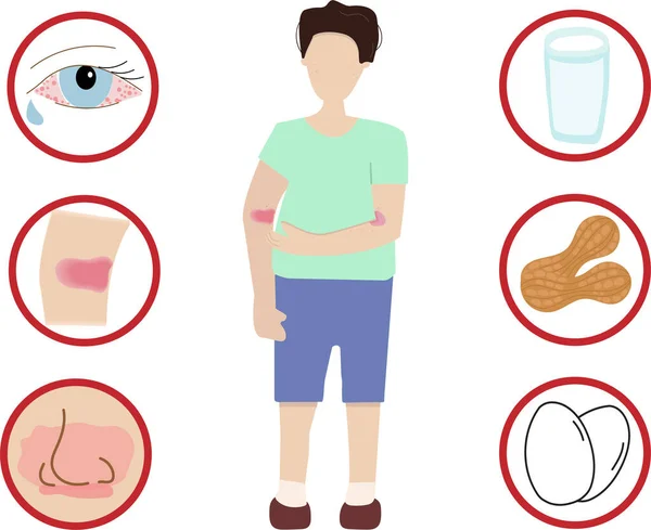 Ilustração Vetorial Design Infográfico Menino Alergia Alimentar Mão Desenhe Estilo — Vetor de Stock