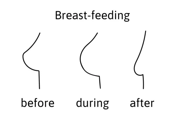 Il seno femminile durante l'allattamento prima di esso, normale. Poi cambia in grande durante l'alimentazione. dopo che quella ghiandola mammaria diventa piccola. Illustrazione vettoriale isolata su bianco. — Vettoriale Stock