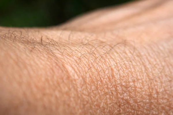 Hand huid met gezwollen aderen. — Stockfoto