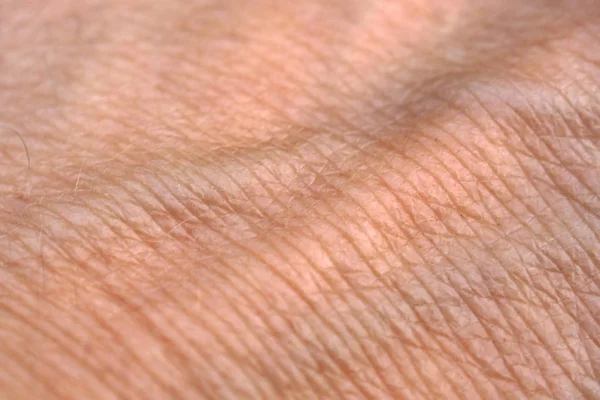 Hand skin with swollen Veins. — Stock Photo, Image