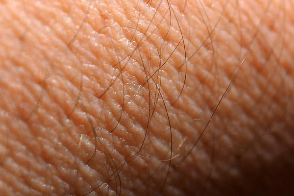 Kulit seorang pria dengan rambut . — Stok Foto