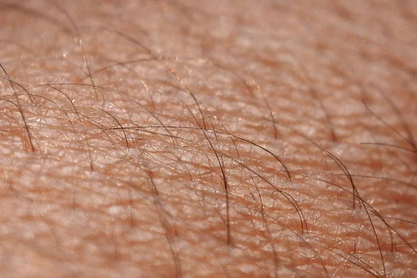 La piel de un hombre con pelo . — Foto de Stock