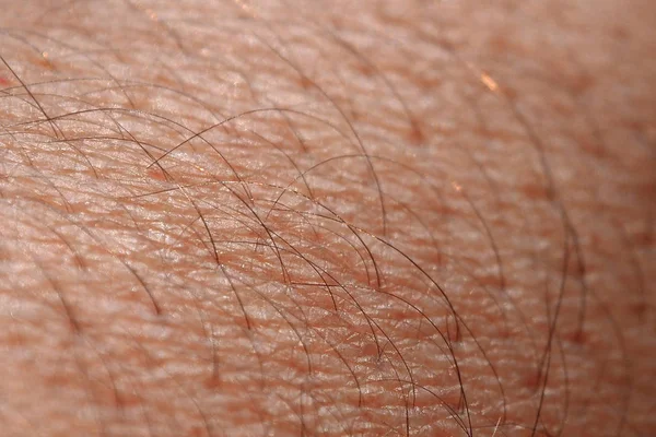 La piel de un hombre con pelo . —  Fotos de Stock