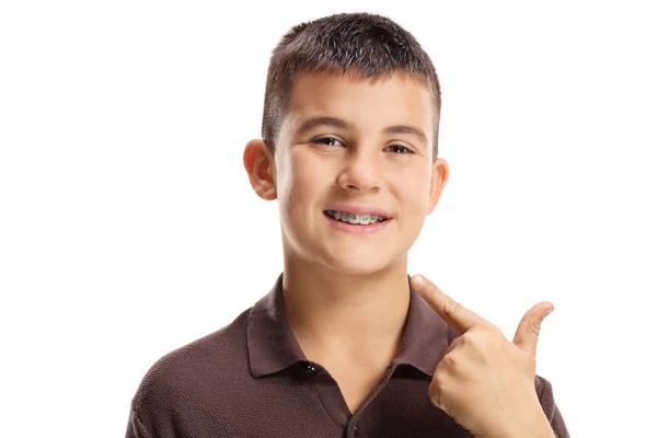 Мальчик Зубными Скобками Указывающими Рот Изолированный Белом Фоне — стоковое фото