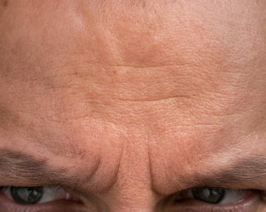 Ayrıntıları kaşlarını çatmış bir adamın alnıyla kapat..