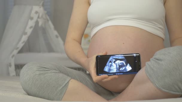 Examen échographique du fœtus dans les mains d'une femme enceinte — Video