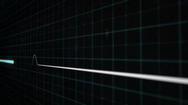 Modern tıbbi ekranda EKG ya da EKG düz çizgi