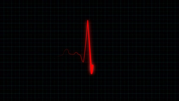 Monitor médico de electrocardiograma de frecuencia cardíaca — Vídeo de stock