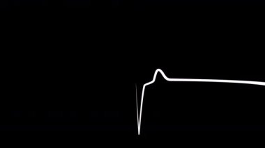 Kalp atışı düzensiz. EKG ekranında kırmızı kalp atışı
