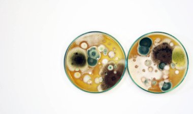 Klinik numunelerde mantar, maya kolonileri, mantar testleri, Petri kabında Malt Extract Agar büyüme medyasının hava odasındaki kirliliğin araştırılması ve izole edilmesi için kullanılması..