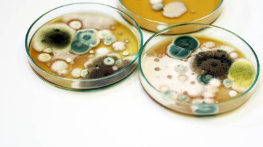 Klinik numunelerde mantar, maya kolonileri, mantar testleri, Petri kabında Malt Extract Agar büyüme medyasının hava odasındaki kirliliğin araştırılması ve izole edilmesi için kullanılması..