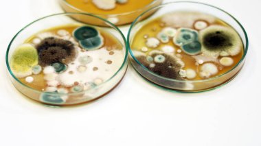 Büyüme medyası için Petri kabında Malt Extract Agar (MEA) kullanarak klinik örneklerde kültür mayaları, kalıplar ve mantar testleri, hava odasındaki çevresel kirlilik kaynaklarını izole etmek ve araştırmak.