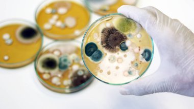 Malt Extract Agar in Petri kabı içinde büyüyen medyada maya, küf ve mantar testi klinik örneklerini izole etmek ve yetiştirmek için kullanılıyor, tıbbi sağlık laboratuvarı hastalıkları analizinde bilim adamlarının elinde tutuluyor.