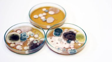 Petri kabında, mantar, maya ve mantar testlerini klinik örneklerden ayırmak ve izole etmek için büyüme medyası için kullanılan Malt özü Agar, hava odasındaki çevresel kirlilik kaynağının araştırılması.