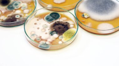 Büyüme medyası için Petri kabında Malt Extract Agar (MEA) kullanarak klinik örneklerde kültür mayaları, kalıplar ve mantar testleri, hava odasındaki çevresel kirlilik kaynaklarını izole etmek ve araştırmak.