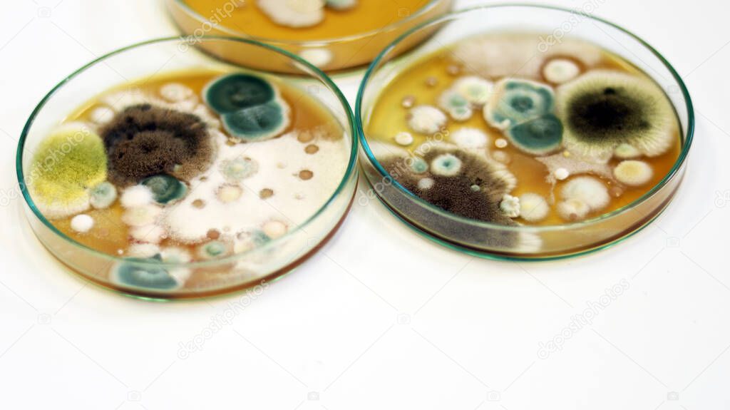 Cultured yeasts, molds and fungal testing in clinical samples, by using Malt Extract Agar (MEA) in Petri dish for growth media, isolate and investigate environmental contamination source in air room.