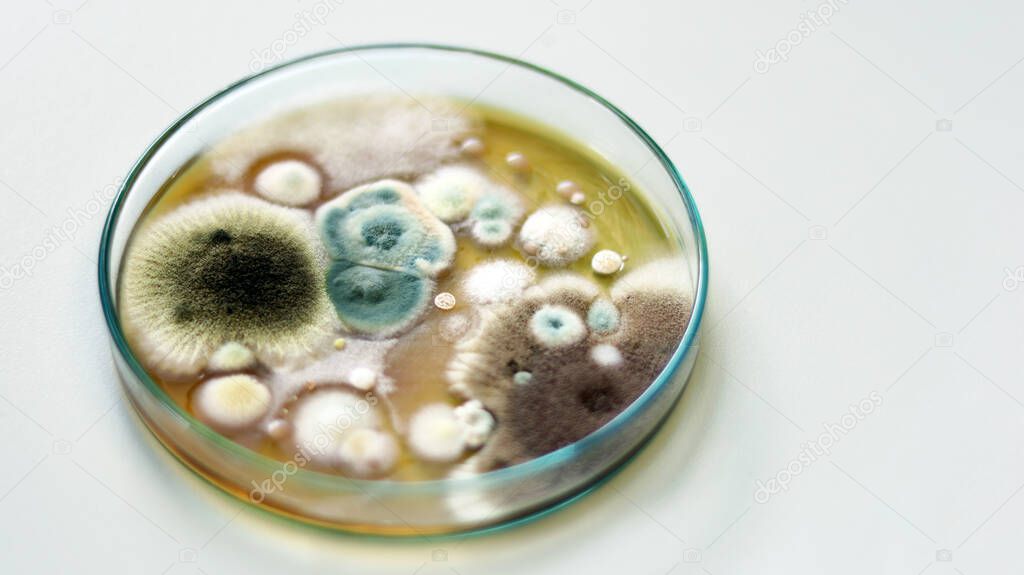 Cultured yeasts, molds and fungal testing in clinical samples, by using Malt Extract Agar (MEA) in Petri dish for growth media, isolate and investigate environmental contamination source in air room.