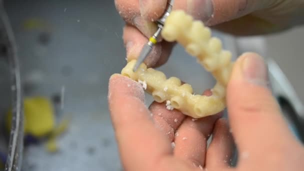 Tandläkare räcka mal tand kronor — Stockvideo