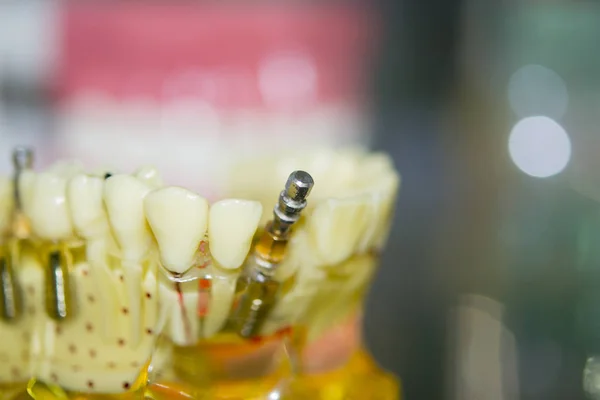 İnsan dişleri şeffaf modeli — Stok fotoğraf