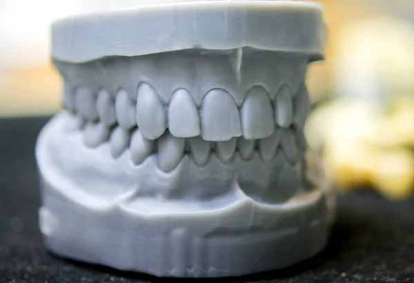Fotopolimer 'in 3d yazıcısına yazdırılmış bir adamın üst ve alt çenesi.