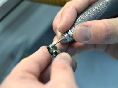 Diş hekimi el değirmenleri 3d yazıcı metal için oluşturulan kron diş.