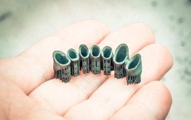 Metal için 3D yazıcıda diş kaplaması oluşturuldu