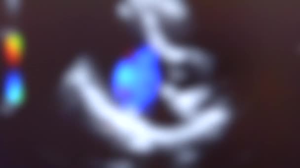 Latar belakang kabur uzi, detak jantung tertutup. Ujian Ultrasound — Stok Video