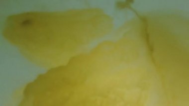 Denizanası denizde suyun altında. Denizanası türleri Rhizostoma pulmo.