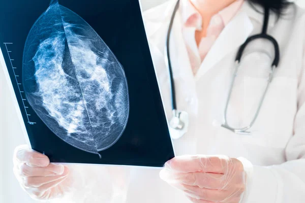 Mammografi sonuçlarına bakan kadın doktor röntgende.