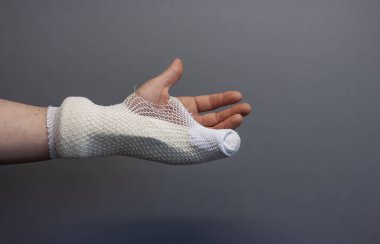 şifa için döküm bandaj yaralı kolu