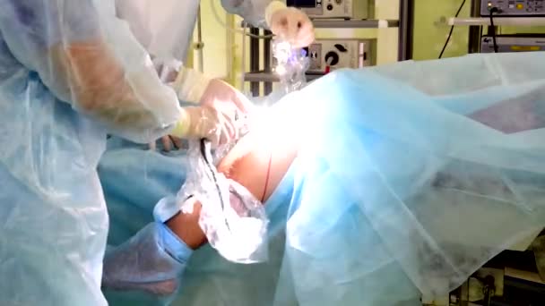 Medicii Făcut Puncție Articulației Genunchiului Pregătesc Echipamente Pentru Chirurgia Minim — Videoclip de stoc