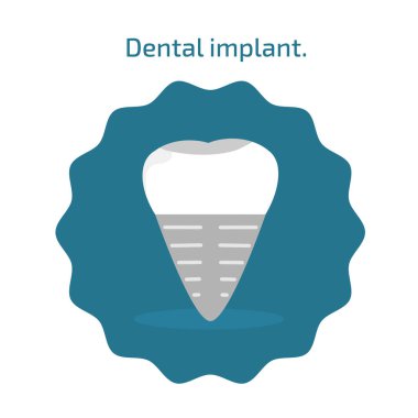 Düz bir şekilde ikon insan diş implantı. Dişçilik için stok vektör illüstrasyonu. Mavi arkaplanda diş simgeleri