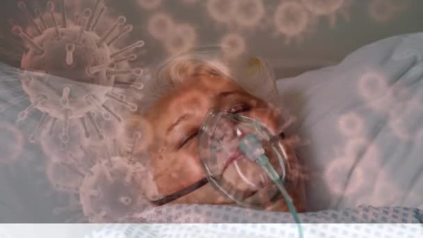 病院で酸素マスクを装着した高齢白人女性の上に浮かぶマクロCovid 19細胞のアニメーション コロナウイルスCovid 19パンデミックコンセプトデジタル複合体 — ストック動画