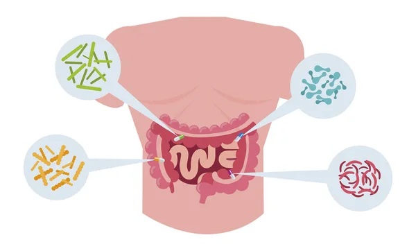 Anatomie van de mens met spijsverteringsstelsel en bacteriën — Stockvector