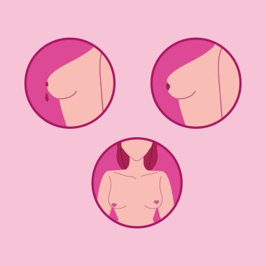 Göğüs kanseri belirtileriyle ilgili ikonlar.