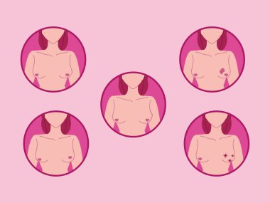 Göğüs kanserinin belirtileri.