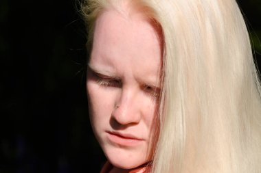 Bir sivrisinek kızların burnuna oturur. Bir kadının yakın çekimi..