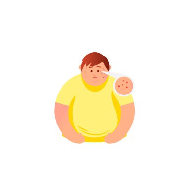 Akne türleri ve yüzünde sivilce ile kız